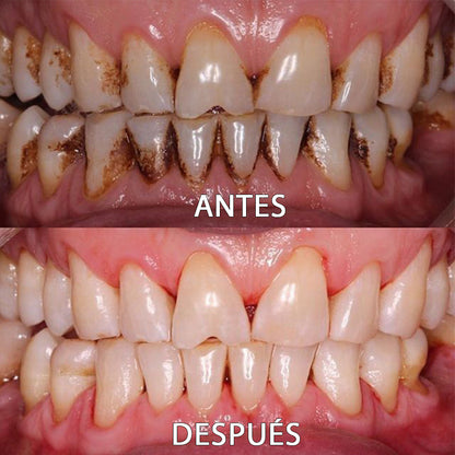 🦷 Polvo Dental ProWhite™ (Reparación Integral)