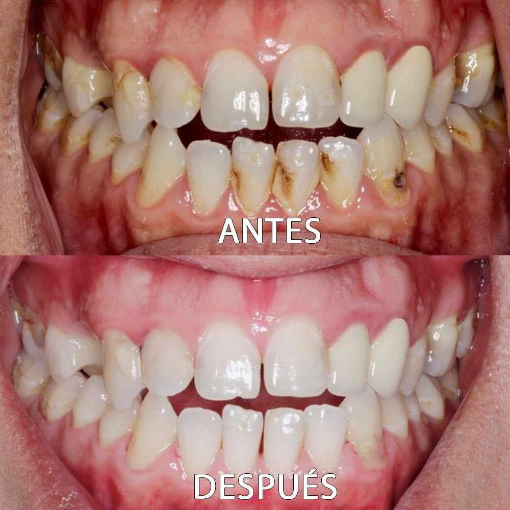 🦷 Polvo Dental ProWhite™ (Reparación Integral)