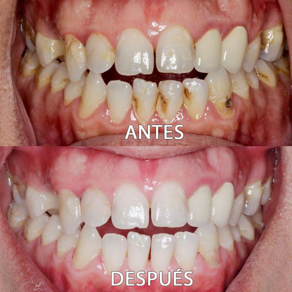 🦷 Polvo Dental ProWhite™ (Reparación Integral)
